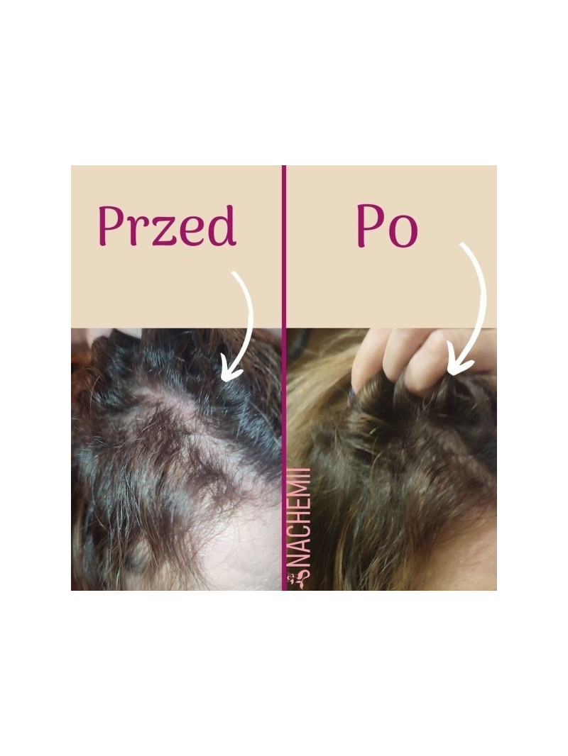 Zestaw serum na pełna kurację - Sklep internetowy