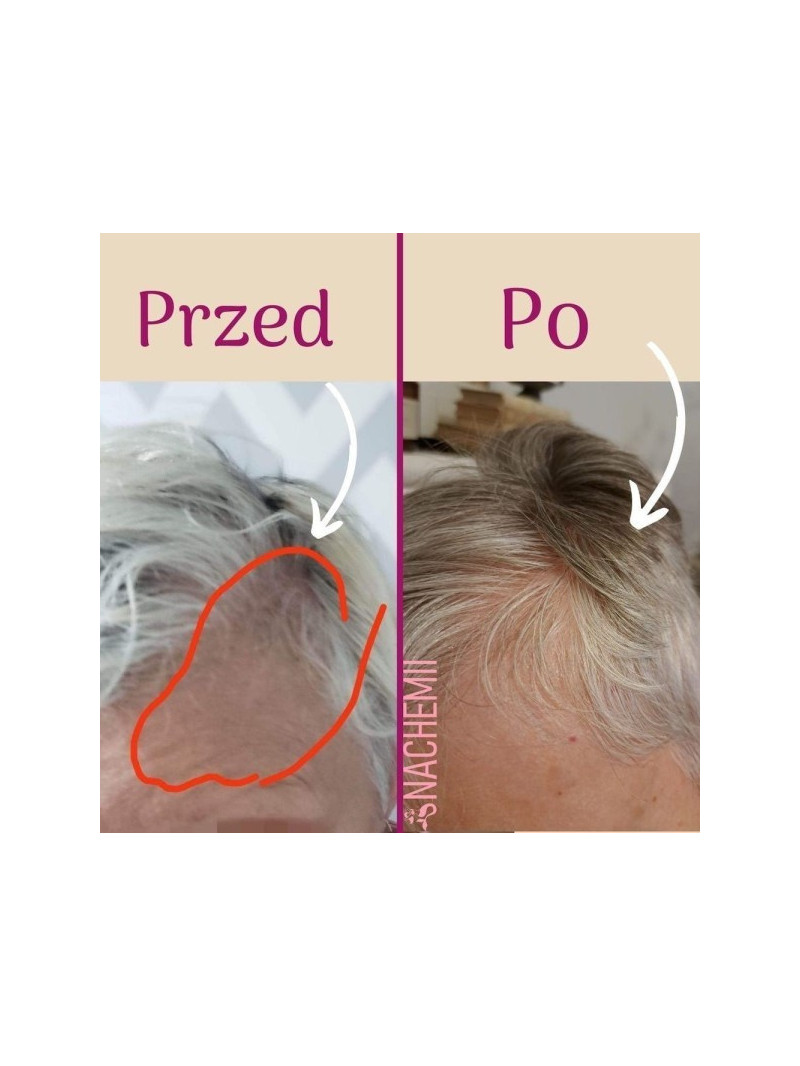 Zestaw serum na pełna kurację - Sklep internetowy