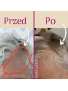 Zestaw serum na pełna kurację - Sklep internetowy