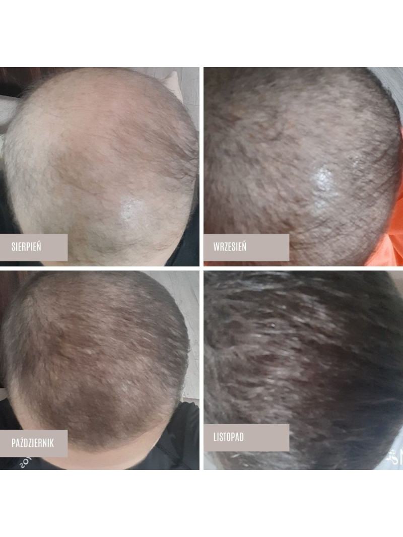 Zestaw serum na pełna kurację - Sklep internetowy