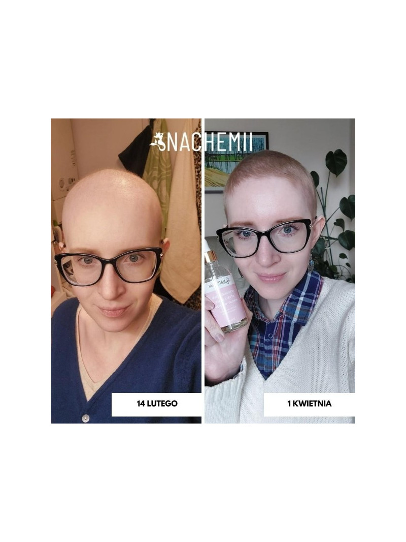 Zestaw serum na pełna kurację - Sklep internetowy
