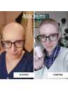 Zestaw serum na pełna kurację - Sklep internetowy