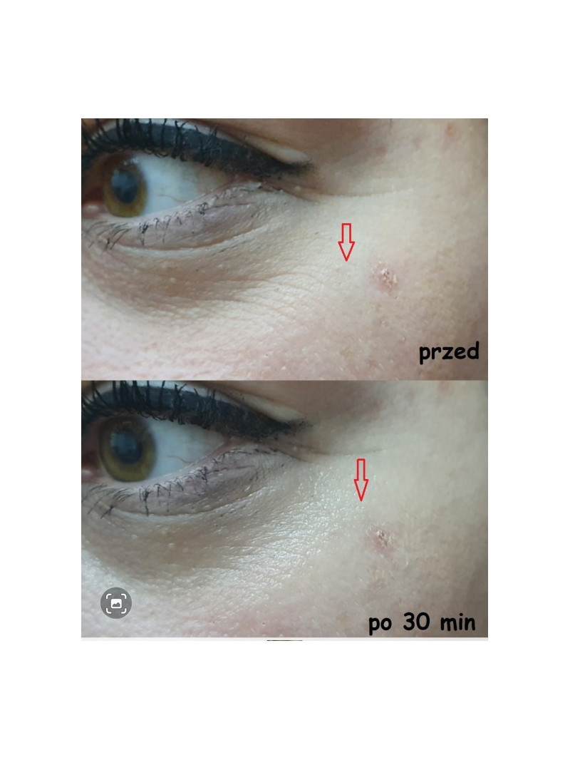 Zestaw - Serum do twarzy - Dwoch opakowan