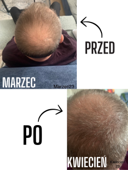 Serum na porost włosów-  dla mężczyzn - sklep internetowy