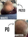 Serum na porost włosów-  dla mężczyzn - sklep internetowy