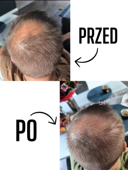 Serum na porost włosów-  dla mężczyzn - sklep internetowy