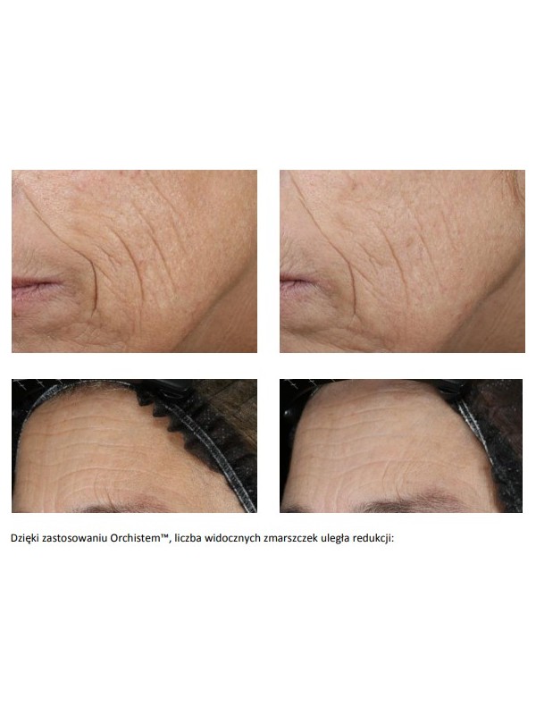 Zestaw dwóch opakowań serum do twarzy