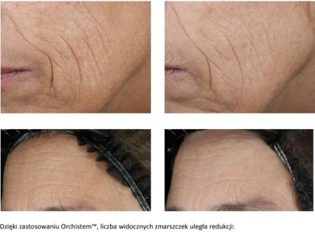 Zestaw dwóch opakowań serum do twarzy