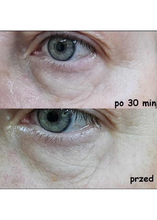 Zestaw dwóch opakowań serum do twarzy