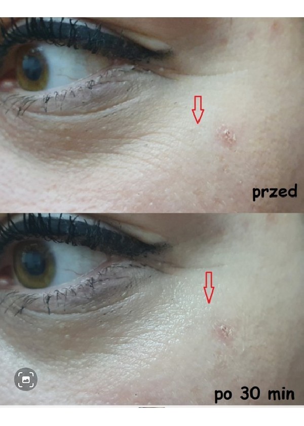 Zestaw dwóch opakowań serum do twarzy