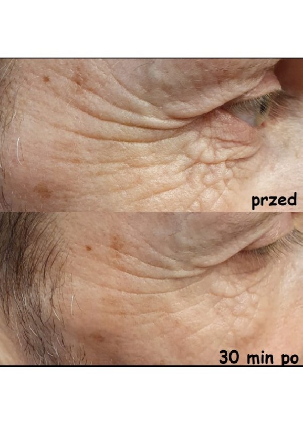 Zestaw dwóch opakowań serum do twarzy