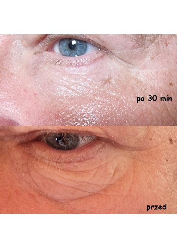 Zestaw dwóch opakowań serum do twarzy