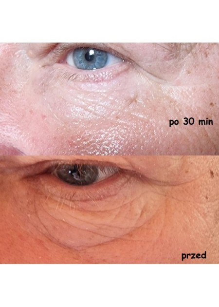 Zestaw dwóch opakowań serum do twarzy