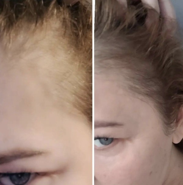 Serum stymulujące porost włosów