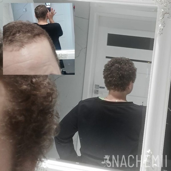 Serum stymulujące porost włosów