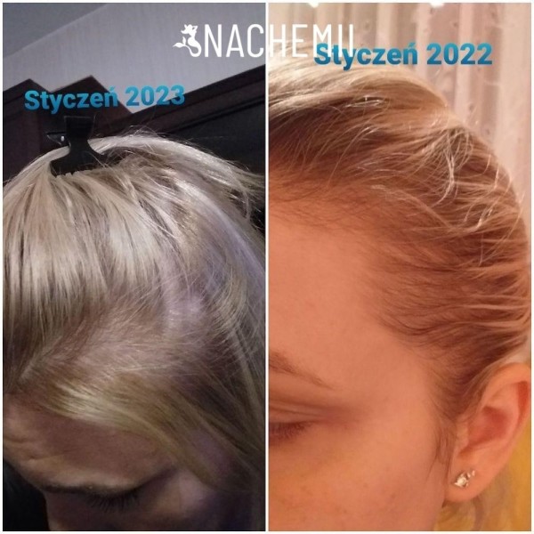 Serum stymulujące porost włosów