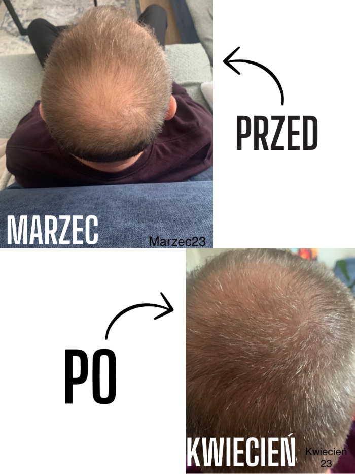 Serum na porost włosów-  dla mężczyzn - sklep internetowy