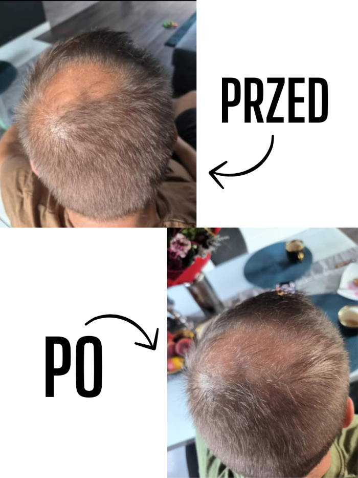 Serum na porost włosów-  dla mężczyzn - sklep internetowy