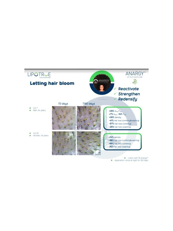 Serum na porost włosów-  dla mężczyzn - sklep internetowy