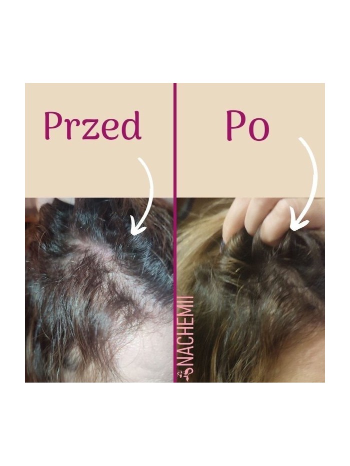 Zestaw serum na pełna kurację - Sklep internetowy
