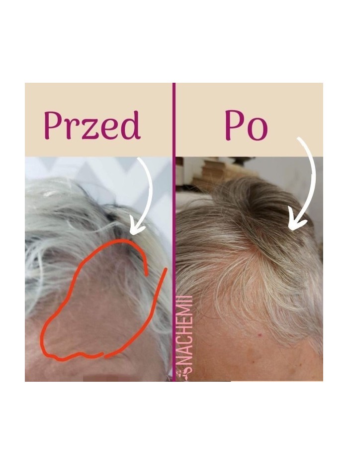Zestaw serum na pełna kurację - Sklep internetowy