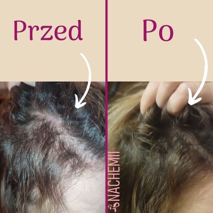 Zestaw serum na pełna kurację - Sklep internetowy