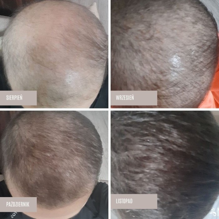 Zestaw serum na pełna kurację - Sklep internetowy