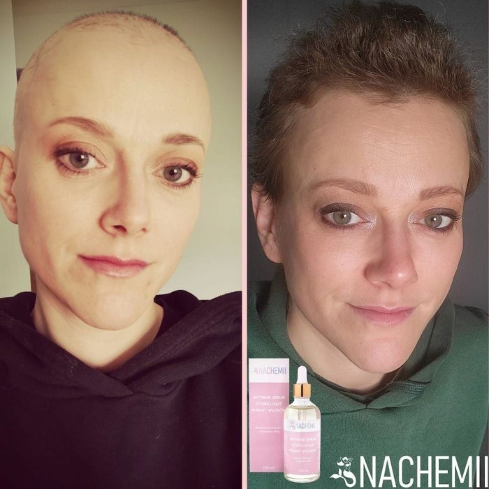 Zestaw serum na pełna kurację - Sklep internetowy