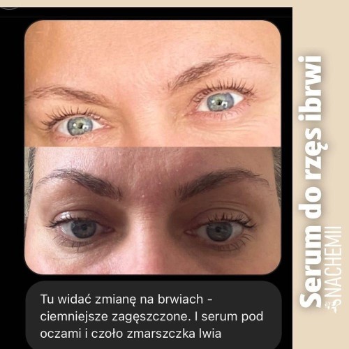 Serum na porost rzęs i brwi - Sklep internetowy