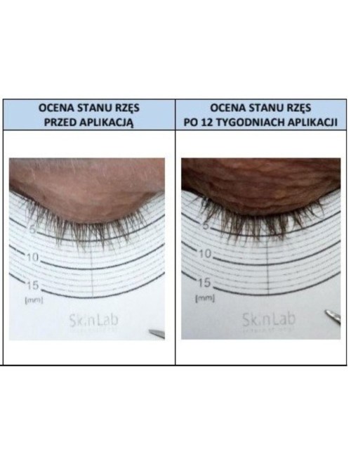 Serum na porost rzęs i brwi - Sklep internetowy