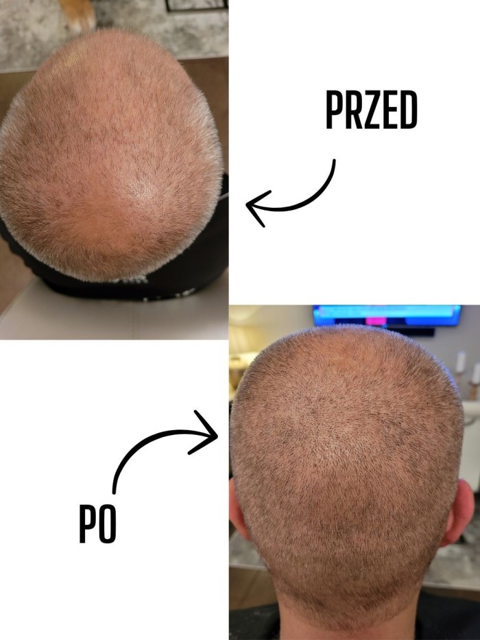 Serum na porost włosów-  dla mężczyzn - sklep internetowy