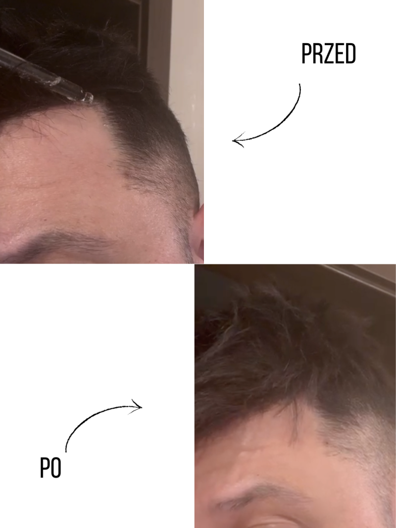 Serum na porost włosów-  dla mężczyzn - sklep internetowy