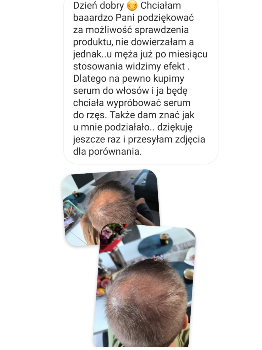 Przed i po — włosy mężczyzn — materiał 3