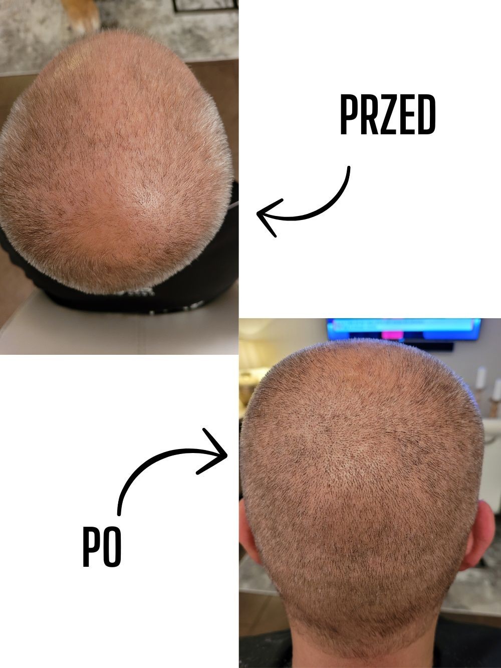 Przed i po — włosy mężczyzn — materiał 8
