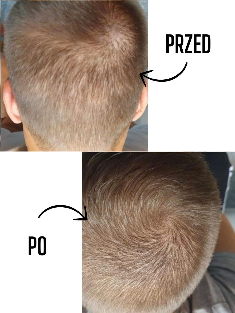 Przed i po — włosy mężczyzn — materiał 6