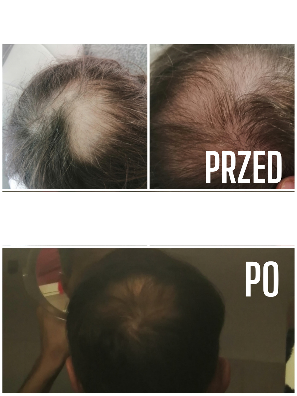 Przed i po — włosy mężczyzn — materiał 7