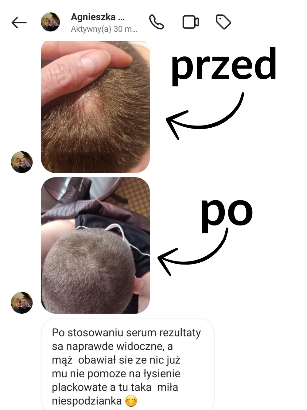 Przed i po — włosy mężczyzn — materiał 4