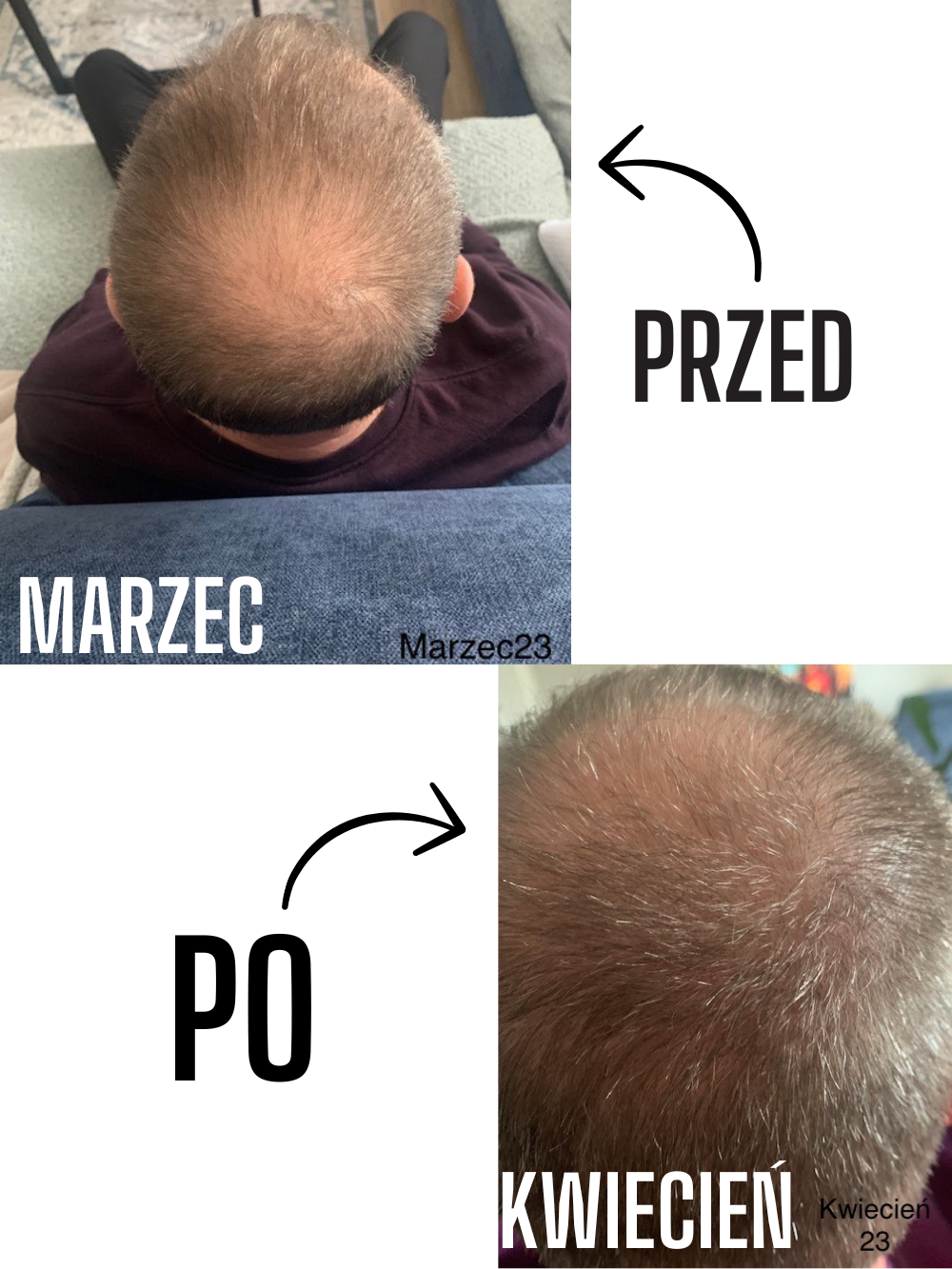Przed i po — włosy mężczyzn — materiał 2