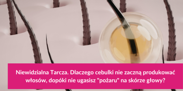 Niewidzialna Tarcza. Dlaczego cebulki nie zaczną produkować włosów, dopóki nie ugasisz "pożaru" na skórze głowy?