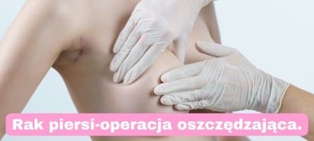 Rak piersi-operacja oszczędzajaca.