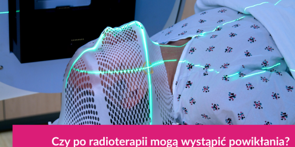 Co to jest radioterapia onkologiczna?