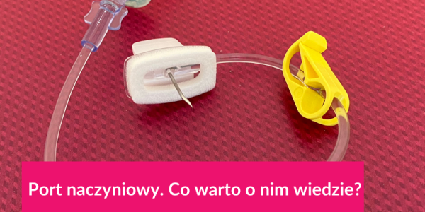Port naczyniowy. Co warto o nim wiedziec?