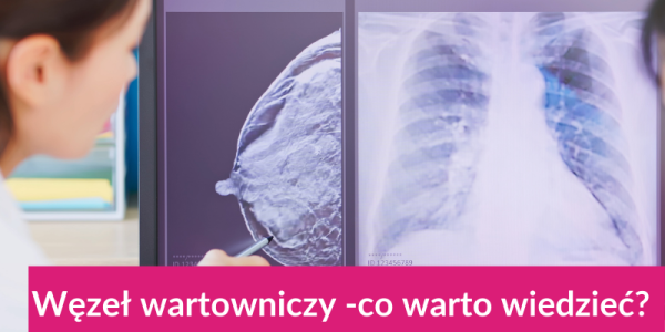 Węzeł wartowniczy - co warto wiedzieć???